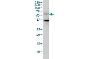 CDC25C monoclonal antibody (M01A), clone 3B11 Western Blot analysis of CDC25C expression in HeLa .