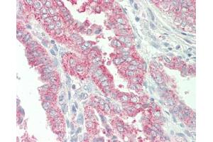 Human Uterus: Formalin-Fixed, Paraffin-Embedded (FFPE). (HBEGF antibody  (N-Term))