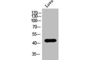 Western Blot analysis of Lovo cells using Phospho-MOR-1 (S375) Polyclonal Antibody