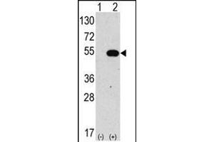Western blot analysis of anti-hG4C-Y48 Pab 1810a in 293 cell line lysates transiently transfected with the ATG4C gene (2 μg/lane). (ATG4C antibody  (N-Term))