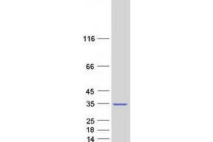 Validation with Western Blot