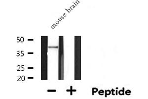SERPINB5 Antikörper  (Internal Region)