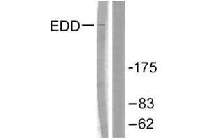 Western blot analysis of extracts from A549 cells, using EDD antibody. (UBR5 antibody)