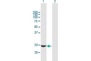 Western Blot analysis of KLK14 expression in transfected 293T cell line by KLK14 MaxPab polyclonal antibody. (Kallikrein 14 antibody  (AA 1-251))