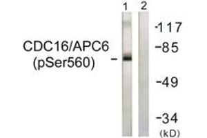Western blot analysis of extracts from HuvEc cells, using CDC16/APC6 (Phospho-Ser560) Antibody. (CDC16 antibody  (pSer560))