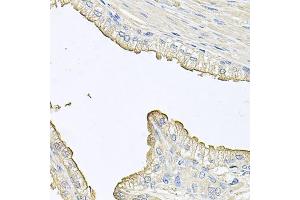 Immunohistochemistry of paraffin-embedded human prostate using FABP12 antibody. (FABP12 antibody)