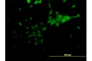 Immunofluorescence (IF) image for anti-Nuclear Receptor Subfamily 2, Group E, Member 1 (NR2E1) (AA 249-342) antibody (ABIN520996)
