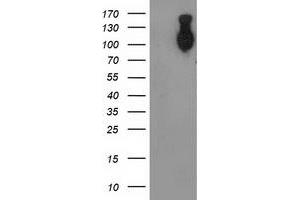 HEK293T cells were transfected with the pCMV6-ENTRY control (Left lane) or pCMV6-ENTRY CDH2 (Right lane) cDNA for 48 hrs and lysed. (N-Cadherin antibody)