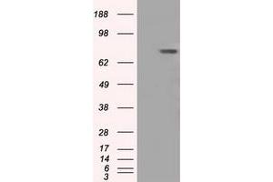 HEK293T cells were transfected with the pCMV6-ENTRY control (Left lane) or pCMV6-ENTRY BTK (Right lane) cDNA for 48 hrs and lysed. (BTK antibody)