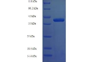 SDS-PAGE (SDS) image for Deoxynucleotidyltransferase, Terminal, Interacting Protein 1 (DNTTIP1) (AA 1-329), (full length) protein (His tag) (ABIN5709415) (DNTTIP1 Protein (AA 1-329, full length) (His tag))