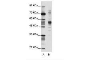 Image no. 1 for anti-Coronin, Actin Binding Protein, 1A (CORO1A) (C-Term) antibody (ABIN202576) (Coronin 1a antibody  (C-Term))
