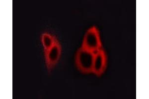 ABIN6267615 staining A549 cells by ICC/IF. (GRIN1/NMDAR1 antibody  (pSer890))