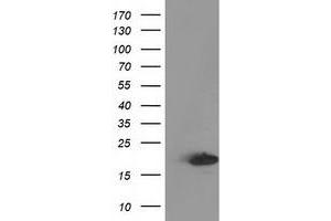 HEK293T cells were transfected with the pCMV6-ENTRY control (Left lane) or pCMV6-ENTRY DSTN (Right lane) cDNA for 48 hrs and lysed. (Destrin antibody)