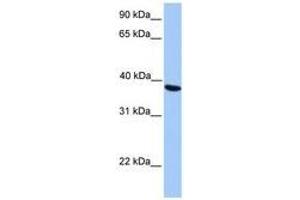 Image no. 1 for anti-N-Acetyltransferase 6 (GCN5-Related) (NAT6) (AA 209-258) antibody (ABIN6738496) (NAT6 antibody  (AA 209-258))