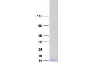 Submaxillary Gland Androgen Regulated Protein 3B (SMR3B) protein (Myc-DYKDDDDK Tag)