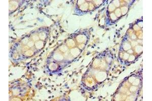 Immunohistochemistry of paraffin-embedded human colon tissue using ABIN7154111 at dilution of 1:100 (GSTM4 antibody  (AA 1-218))