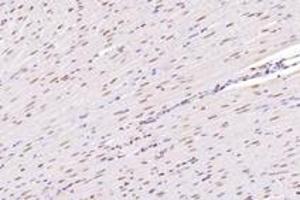Immunohistochemistry analysis of paraffin-embedded rat heart using,NUP133 (ABIN7074909) at dilution of 1: 4800