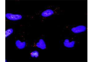 Proximity Ligation Analysis of protein-protein interactions between PLCG2 and ERBB2. (ErbB2/Her2 antibody  (AA 22-121))