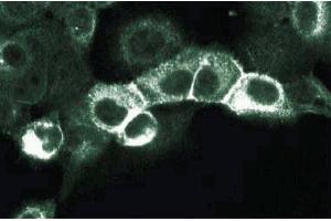 Immunofluorescence staining of A431 cells (Human epithelial carcinoma, ATCC CRL-1555). (ErbB2/Her2 antibody  (AA 182-373))