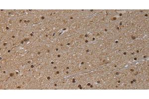 Immunohistochemistry of paraffin-embedded Human brain tissue using NLRP6 Polyclonal Antibody at dilution 1:50 (NLRP6 antibody)