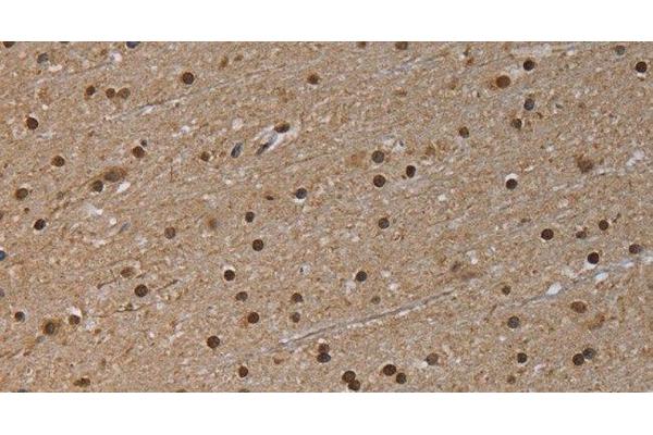 NLRP6 antibody