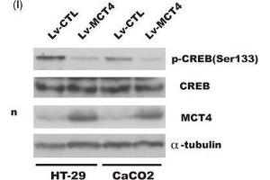 MCT4 inhibits phosphorylation of CREB(Ser133) and attenuates CREB-mediated ZO-1 transactivity. (CREB1 antibody  (pSer133))