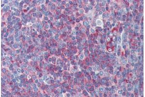 Human Tonsil: Formalin-Fixed, Paraffin-Embedded (FFPE) (Myosin 9 antibody  (C-Term))