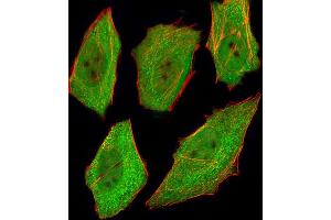 Fluorescent image of  cells stained with VCP Antibody (ABIN1944899 and ABIN2838502). (VCP antibody  (AA 1-225))