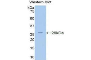 Western Blotting (WB) image for anti-Protein Kinase N2 (PKN2) (AA 282-487) antibody (ABIN1175312)