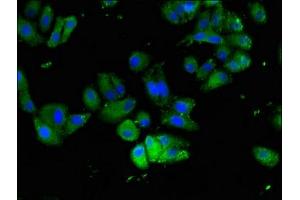 Immunofluorescent analysis of HepG2 cells using ABIN7165354 at dilution of 1:100 and Alexa Fluor 488-congugated AffiniPure Goat Anti-Rabbit IgG(H+L) (FAM111A antibody  (AA 26-179))