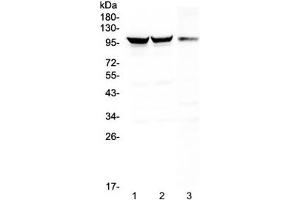 Western blot testing of 1) rat brain, 2) mouse brain and 3) mouse NIH3T3 lysate with Dynamin 1 antibody at 0.