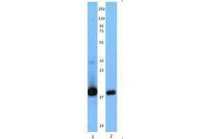 Western Blotting (WB) image for anti-Interleukin 21 (IL21) antibody (ABIN2666226) (IL-21 antibody)