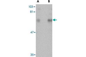Western blot analysis of CPEB1 in rat brain tissue lysate with CPEB1 polyclonal antibody  at (A) 1 and (B) 2 ug/mL . (CPEB1 antibody  (N-Term))