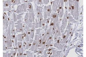 ABIN6268814 at 1/100 staining human Heart muscle tissue sections by IHC-P.