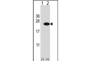 Western blot analysis of CIRBP (arrow) using rabbit polyclonal CIRBP Antibody (C-term) (ABIN653083 and ABIN2842680). (CIRBP antibody  (C-Term))