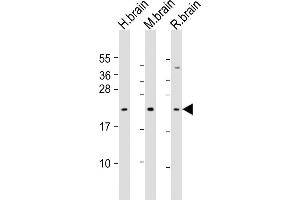All lanes : Anti-FGF12 Antibody (Center) at 1:1000 dilution Lane 1: human brain lysate Lane 2: mouse brain lysate Lane 3: rat brain lysate Lysates/proteins at 20 μg per lane. (FGF12 antibody  (AA 159-191))