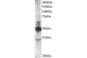 Western Blotting (WB) image for anti-GATA Binding Protein 3 (GATA3) (N-Term) antibody (ABIN2465221) (GATA3 antibody  (N-Term))