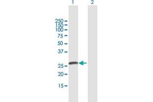 Western Blot analysis of SPC25 expression in transfected 293T cell line by SPC25 MaxPab polyclonal antibody.