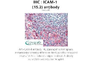 Image no. 2 for anti-Intercellular Adhesion Molecule 1 (ICAM1) antibody (ABIN1723250) (ICAM1 antibody)