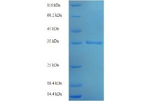 SDS-PAGE (SDS) image for Malignant T Cell Amplified Sequence 1 (MCTS1) (AA 1-181), (full length) protein (His-SUMO Tag) (ABIN5711965) (MCTS1 Protein (AA 1-181, full length) (His-SUMO Tag))