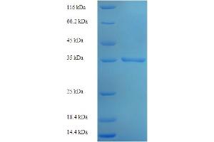 SDS-PAGE (SDS) image for Malignant T Cell Amplified Sequence 1 (MCTS1) (AA 1-181), (full length) protein (His-SUMO Tag) (ABIN4975661) (MCTS1 Protein (AA 1-181, full length) (His-SUMO Tag))