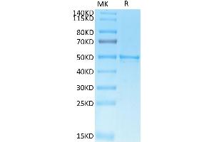 SARS-COV-2 Nucleocapsid on Tris-Bis PAGE under reduced condition. (SARS-CoV-2 Nucleocapsid Protein (SARS-CoV-2 N) (His-Avi Tag))