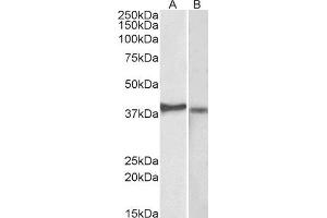 ABIN2562069 (2µg/ml) staining of Kelly (A) and U251-MG (B) lysates (35µg protein in RIPA buffer). (CX3CR1 antibody  (N-Term))