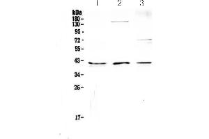 Western blot analysis of CD47 using anti-CD47 antibody .