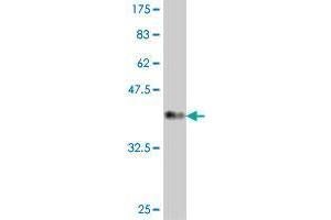 Western Blot detection against Immunogen (37. (Plakophilin 3 antibody  (AA 225-324))
