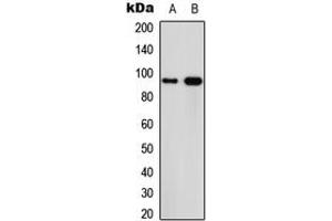 Western blot analysis of Calpain 3 expression in MCF7 (A), PC12 (B) whole cell lysates. (Calpain 3 antibody  (Center))