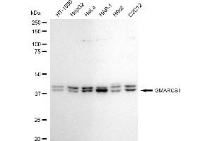 Western blotting analysis using SMARCB1 antibody (ABIN7800478).