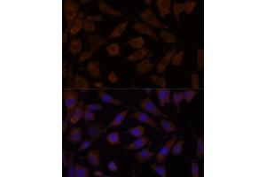 Immunofluorescence analysis of L929 cells using OXSR1 antibody (ABIN7269132) at dilution of 1:100. (OXSR1 antibody  (AA 1-100))