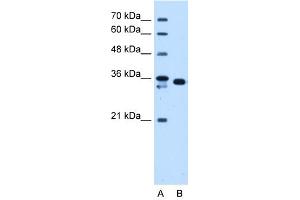 WB Suggested Anti-AKR1B1 Antibody Titration:  1.