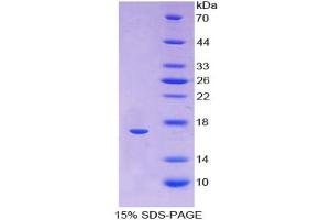 SDS-PAGE analysis of Human Hemoglobin alpha 1 Protein. (HBA1 Protein)